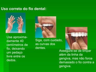 Uso correto do fio dental:   Assegure-se de limpar além da linha da gengiva, mas não force demasiado o fio contra a gengiva.  Siga, com cuidado, as curvas dos dentes. Use aproxima- damente 40 centímetros de fio, deixando um pedaço livre entre os dedos. 