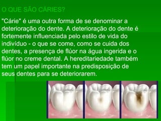 O QUE SÃO CÁRIES? "Cárie" é uma outra forma de se denominar a deterioração do dente. A deterioração do dente é fortemente influenciada pelo estilo de vida do indivíduo - o que se come, como se cuida dos dentes, a presença de flúor na água ingerida e o flúor no creme dental. A hereditariedade também tem um papel importante na predisposição de seus dentes para se deteriorarem. 