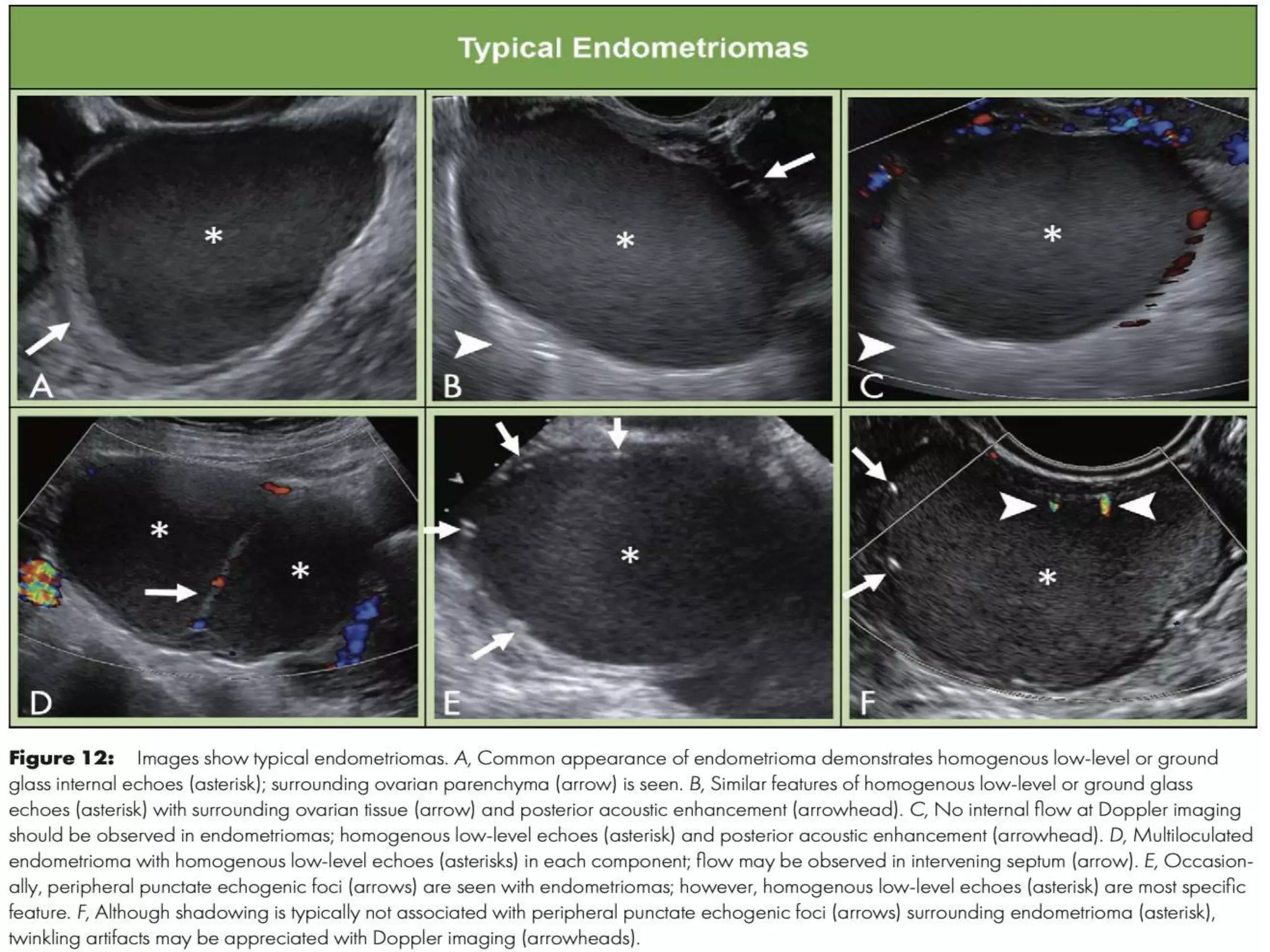 O'rads Radiology 2020 | PPTX