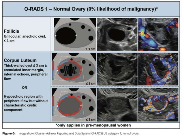 O'rads Radiology 2020 | PPTX