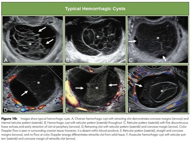 O'rads Radiology 2020 | PPTX