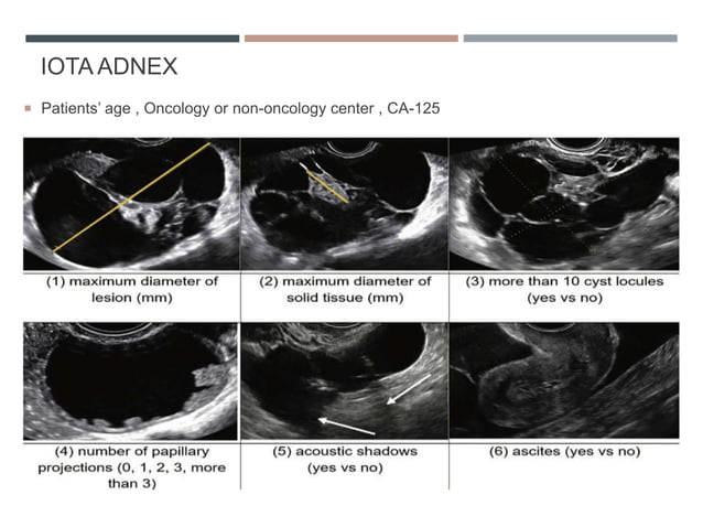 O'rads Radiology 2020 | PPTX