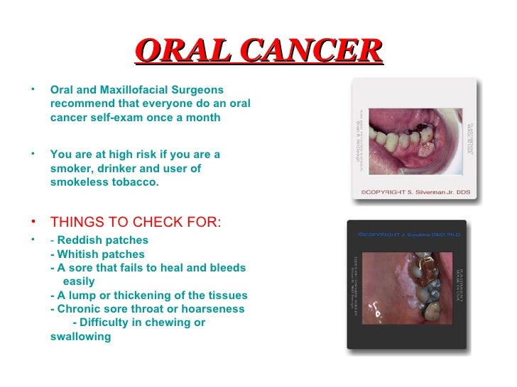 Oral And Maxillofacial Surgeons