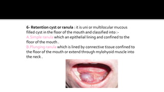 Oral cavity ppt- college seminar
