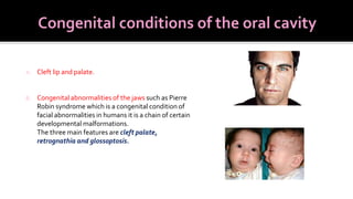 Oral cavity ppt- college seminar