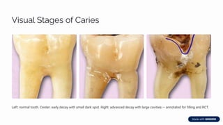 Oral-Mucosal-and-Dental-Disorders-Overview.pdf