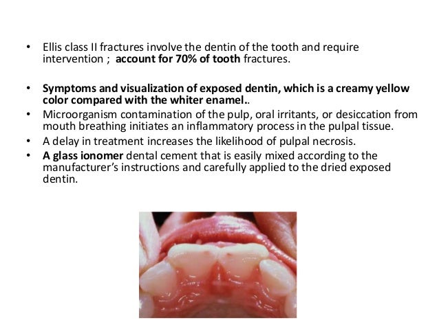 Oral and dental emergencies
