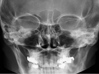 Oral and Maxillofacial Radiology | PPTX