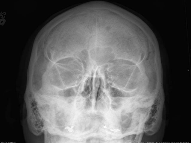 Oral and Maxillofacial Radiology | PPTX