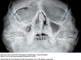 Oral and Maxillofacial Radiology | PPTX