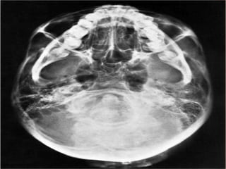 Oral and Maxillofacial Radiology | PPTX