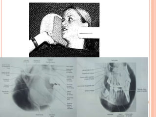 Oral and Maxillofacial Radiology | PPTX