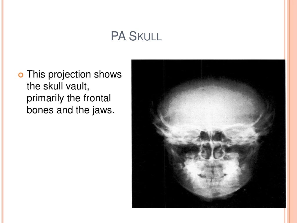 Oral and Maxillofacial Radiology