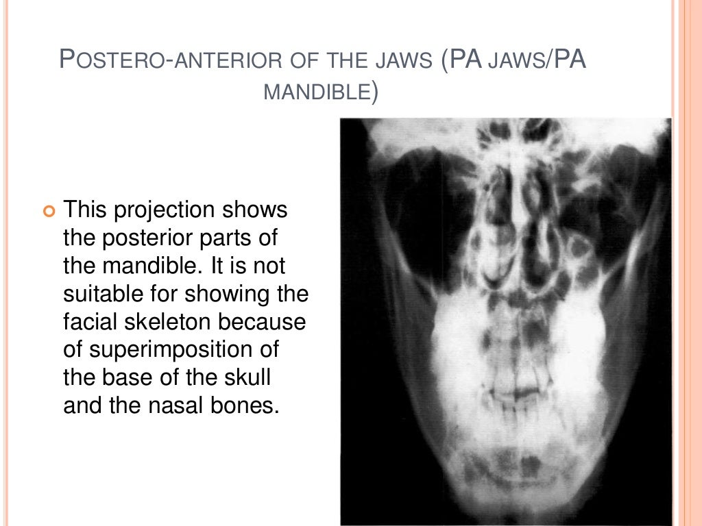 Oral and Maxillofacial Radiology