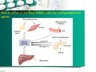 Sites of action of the most widely used oral antihyperglycemic
agents.
 