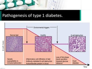 Pathogenesis of type 1 diabetes.
 