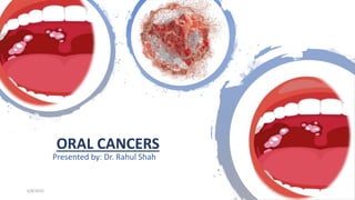 ORAL CANCERS
Presented by: Dr. Rahul Shah
6/8/2022
 