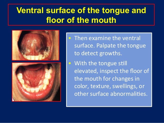 Oral Cancer