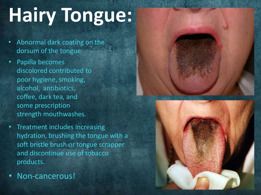 The Dangers of Tobacco Use in Oral and Systemic Health