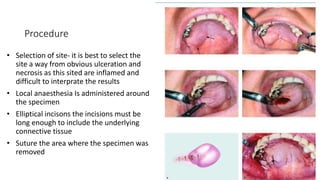 Procedure
• Selection of site- it is best to select the
site a way from obvious ulceration and
necrosis as this sited are inflamed and
difficult to interprate the results
• Local anaesthesia Is administered around
the specimen
• Elliptical incisons the incisions must be
long enough to include the underlying
connective tissue
• Suture the area where the specimen was
removed
 