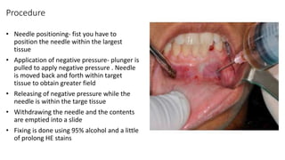 Procedure
• Needle positioning- fist you have to
position the needle within the largest
tissue
• Application of negative pressure- plunger is
pulled to apply negative pressure . Needle
is moved back and forth within target
tissue to obtain greater field
• Releasing of negative pressure while the
needle is within the targe tissue
• Withdrawing the needle and the contents
are emptied into a slide
• Fixing is done using 95% alcohol and a little
of prolong HE stains
 