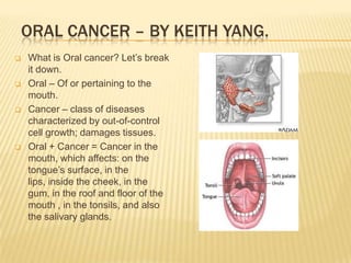 ORAL CANCER – BY KEITH YANG.
   What is Oral cancer? Let’s break
    it down.
   Oral – Of or pertaining to the
    mouth.
   Cancer – class of diseases
    characterized by out-of-control
    cell growth; damages tissues.
   Oral + Cancer = Cancer in the
    mouth, which affects: on the
    tongue’s surface, in the
    lips, inside the cheek, in the
    gum, in the roof and floor of the
    mouth , in the tonsils, and also
    the salivary glands.         
 