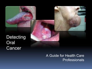 Detecting
Oral
Cancer
            A Guide for Health Care
                      Professionals
 