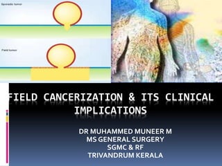 FIELD CANCERIZATION & ITS CLINICAL
IMPLICATIONS
DR MUHAMMED MUNEER M
MS GENERAL SURGERY
SGMC & RF
TRIVANDRUM KERALA
 