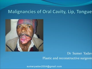 Dr Sumer Yadav
Plastic and reconstructive surgeon
sumeryadav2004@gmail.com
 