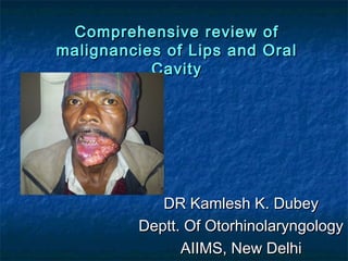 Comprehensive review of
malignancies of Lips and Oral
           Cavity




            DR Kamlesh K. Dubey
         Deptt. Of Otorhinolaryngology
               AIIMS, New Delhi
 