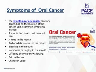 Oral Cancer Risk Factors Part 3 And Symptoms