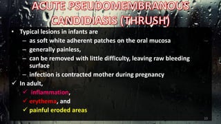 • Typical lesions in infants are
– as soft white adherent patches on the oral mucosa
– generally painless,
– can be removed with little difficulty, leaving raw bleeding
surface
– infection is contracted mother during pregnancy
 In adult,
 inflammation,
 erythema, and
 painful eroded areas
10
 