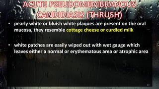 • pearly white or bluish white plaques are present on the oral
mucosa, they resemble cottage cheese or curdled milk
• white patches are easily wiped out with wet gauge which
leaves either a normal or erythematous area or atrophic area
13
 