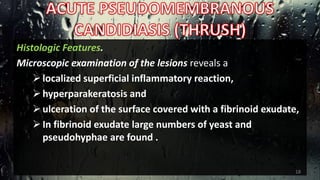 Histologic Features.
Microscopic examination of the lesions reveals a
localized superficial inflammatory reaction,
hyperparakeratosis and
ulceration of the surface covered with a fibrinoid exudate,
In fibrinoid exudate large numbers of yeast and
pseudohyphae are found .
18
 