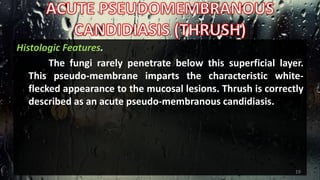 Histologic Features.
The fungi rarely penetrate below this superficial layer.
This pseudo-membrane imparts the characteristic white-
flecked appearance to the mucosal lesions. Thrush is correctly
described as an acute pseudo-membranous candidiasis.
19
 