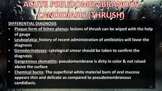 DIFFERENTIAL DIAGNOSIS
• Plaque form of lichen planus: lesions of thrush can be wiped with the help
of gauge
• Leukoplakia: history of recent administration of antibiotics will favor the
diagnosis
• Genodermatoses: cytological smear should be taken to confirm the
diagnosis
• Gangrenous stomatitis: pseudomembrane is dirty in color & not raised
above the surface
• Chemical burns: The superficial white material burn of oral mucosa
appears thin and delicate as compared to pseudomembranous
candidiasis.
20
 
