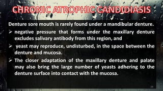 Denture sore mouth is rarely found under a mandibular denture.
 negative pressure that forms under the maxillary denture
excludes salivary antibody from this region, and
 yeast may reproduce, undisturbed, in the space between the
denture and mucosa.
 The closer adaptation of the maxillary denture and palate
may also bring the large number of yeasts adhering to the
denture surface into contact with the mucosa.
29
 