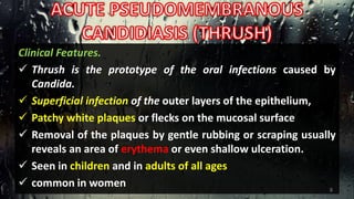 Clinical Features.
 Thrush is the prototype of the oral infections caused by
Candida.
 Superficial infection of the outer layers of the epithelium,
 Patchy white plaques or flecks on the mucosal surface
 Removal of the plaques by gentle rubbing or scraping usually
reveals an area of erythema or even shallow ulceration.
 Seen in children and in adults of all ages
 common in women 8
 
