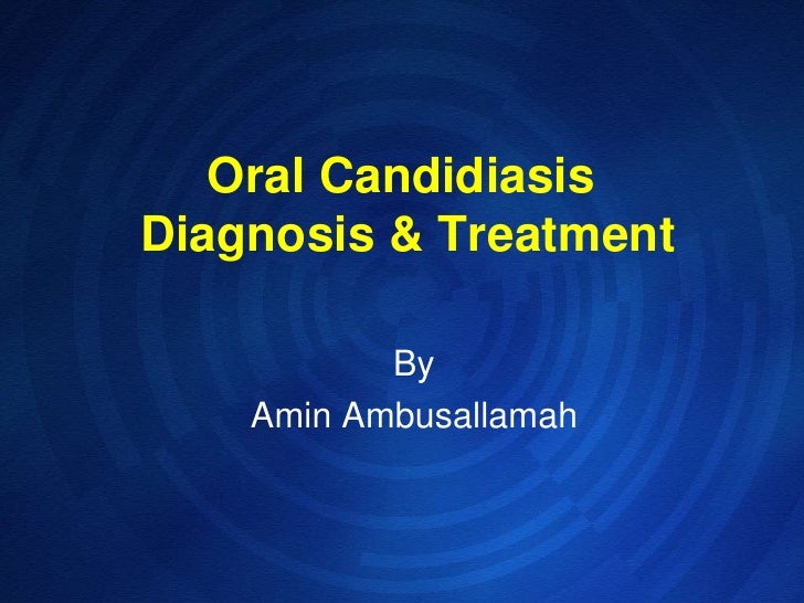 oral candida treatment