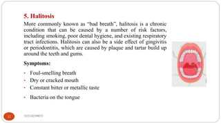 182520290033
12
5. Halitosis
More commonly known as “bad breath”, halitosis is a chronic
condition that can be caused by a number of risk factors,
including smoking, poor dental hygiene, and existing respiratory
tract infections. Halitosis can also be a side effect of gingivitis
or periodontitis, which are caused by plaque and tartar build up
around the teeth and gums.
Symptoms:
• Foul-smelling breath
• Dry or cracked mouth
• Constant bitter or metallic taste
• Bacteria on the tongue
 