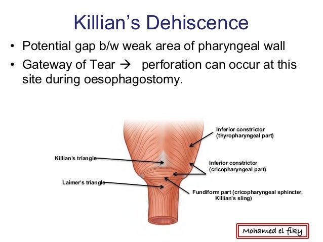Killian Triangle - markered.