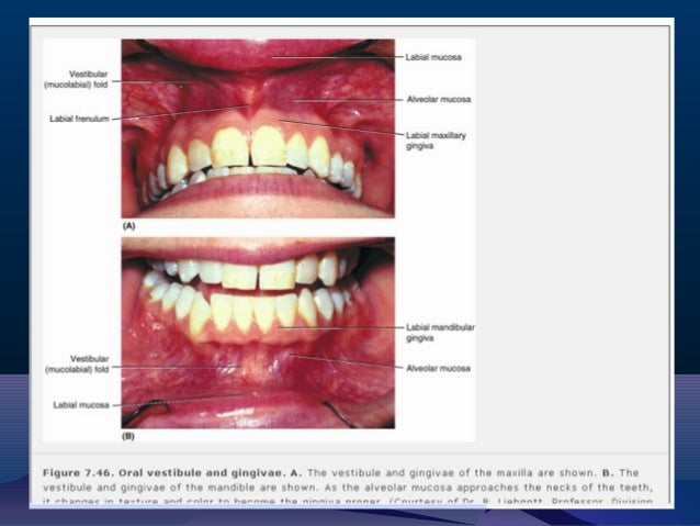 Anatomy of Oral cavity and tongue