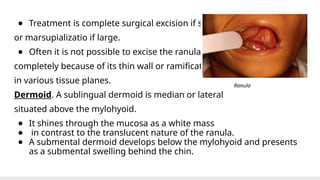 Marsupialization Small Ranula oral cavity DISORDERS but benign and premalignant lesions.pptx