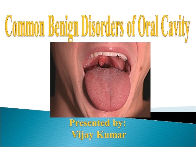 oral problem mucosa disorders kumar Benign cavity Dr.vijay by. Common Oral