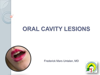  ORAL CAVITY LESIONS  Frederick Mars Untalan, MD