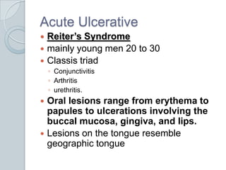 Acute UlcerativeReiter’s Syndromemainly young men 20 to 30Classis triad ConjunctivitisArthritisurethritis. Oral lesions range from erythema to papules to ulcerations involving the buccal mucosa, gingiva, and lips. Lesions on the tongue resemble geographic tongue