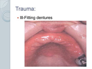 Trauma:Ill-Fitting dentures