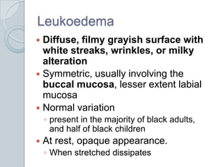 LeukoedemaDiffuse, filmy grayish surface with white streaks, wrinkles, or milky alterationSymmetric, usually involving the buccal mucosa, lesser extent labial mucosaNormal variationpresent in the majority of black adults, and half of black childrenAt rest, opaque appearance. When stretched dissipates