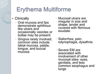 Erythema MultiformeClinicallyOral mucosa and lips demonstrate aphthous like ulcers and occasionally vesicles or bullae may be present.Gingiva rarely involved; common sites include labial mucosa, palate, tongue, and buccalmucosaMucosal ulcers are irregular in size and shape, tender and covered with fibrinousexudate.Sialorrhea, pain, odynophagia, dysathria. Severe EM are associated with involvement of other mucosal sites- eyes, genitalia, and less common esophagus and lungs