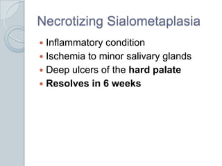 Necrotizing Sialometaplasia<br />Inflammatory condition<br />Ischemia to minor salivary glands<br />Deep ulcers of the har...